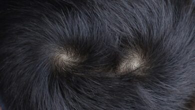 Tempat tumbuh rambut di kepala yang bentuknya melingkar TTS