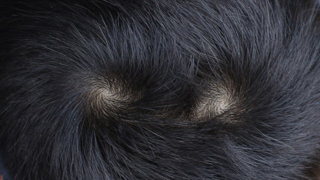 Tempat tumbuh rambut di kepala yang bentuknya melingkar TTS